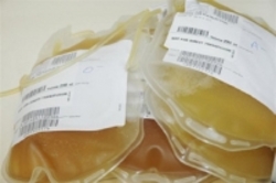 ارسال 4500 واحد پلاسمای خون از خراسان‌شمالی به خارج از کشور