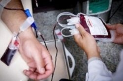 کاهش چشمگیر انتقال HIV از طریق خون‌ و فرآورده‌های خونی